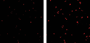 human tumor cell image viewed with Semrock Brightline FISH filter versus competitor
