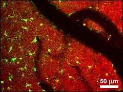 Multiphoton in-vivo fluorescence image