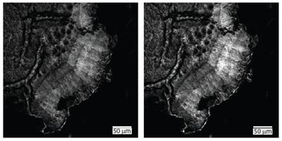 cholesteryl palmitate from a fixed tissue sample CARS microscopy image