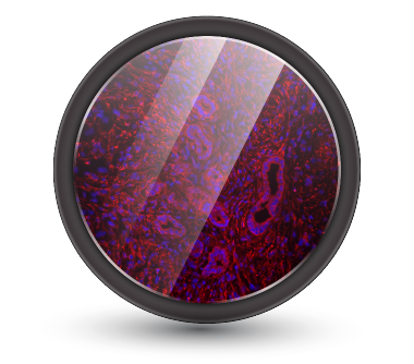 Brightline Basic filter