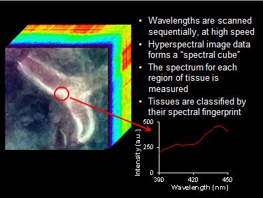 hyperspectral imaging of tissues