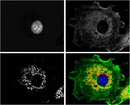 cellular components labeled with specific fluorophores