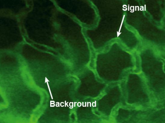 background fluorescence observed on a sample of mouse prostate vasculature (blood vessels)